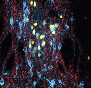 [Архэ] Сергей Лопатин ― Биология стресса. Лекция 3_0.jpg